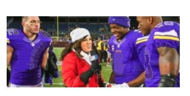 Michele Tafoya Braves The Cold